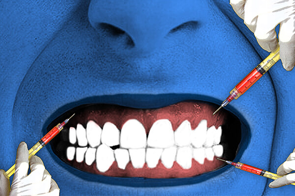dental implant dentist
