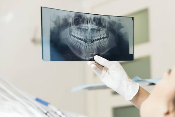 dental x ray services
