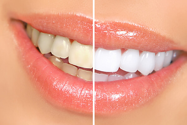 cosmetic dentistry

